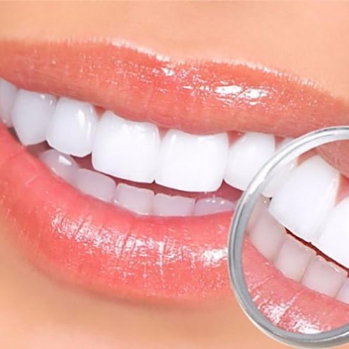 Teeth whitening Pen