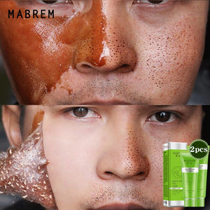 Blackhead Remover Mask Face Whitening