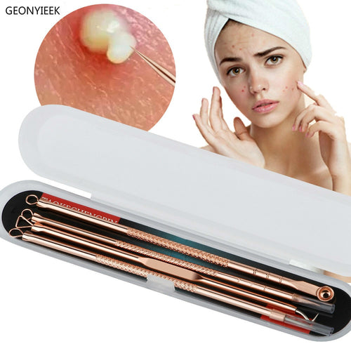 Rose Gold 4pcs/set Blackhead Comedone Acne